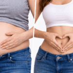 Blähbauch loswerden